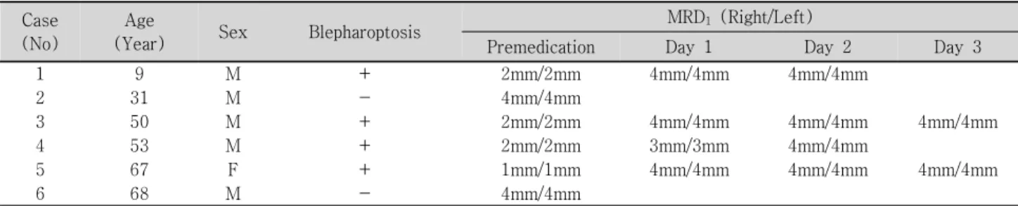 Table  3. Summary  of  blepharoptosis  before  &amp;  after  anticholinesterase  treatment Case