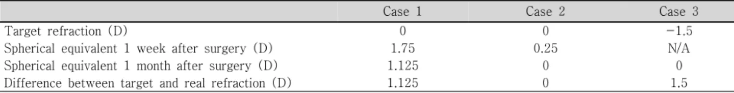 Table  3. Comparison  of  target  refraction  and  real  refraction  after  cataract  surgery
