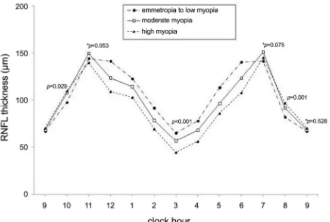 Figure 2. RNFL profiles and clock hour RNFL thickness of  the  group  A  (emmetropia  to  low  myopia),  group  B  (moderate myopia) and group C (high myopia)