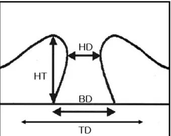 Figure 1. Preoperative parameters of macular hole on optical  coherence tomography. HT=height; HD=hole diameter; BD= 