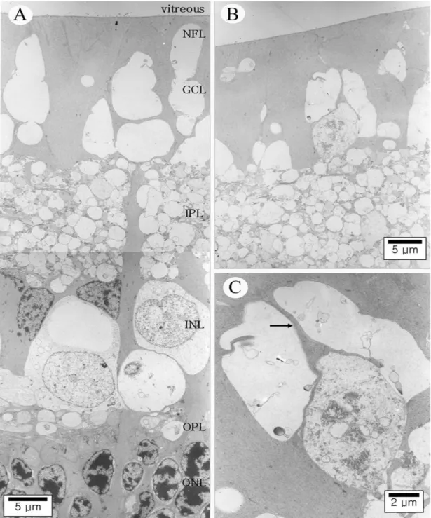 Figure 3. Ultrastructure of the detached rabbit retina four weeks after surgery. (A) The outer nuclear layer (ONL) is severe  reduced in thickness