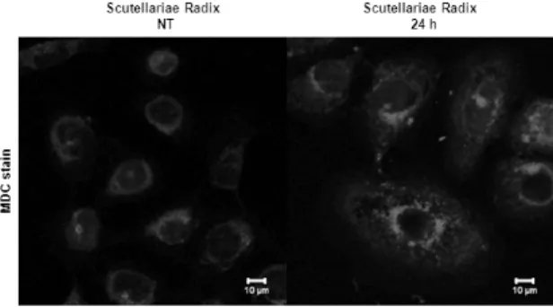 Fig. 4. Scutellariae Radix induces autophagy by MDC stain using confocal microscope on SCC 25 cells
