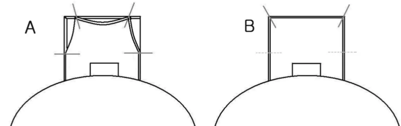 Figure 1. Techniques of scleral flap suture. (A) Modified trabeculectomy. (B) Standard trabeculectomy