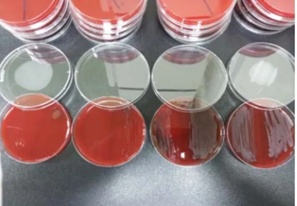 Fig. 2. Blood agar plates for minimum bactericidal concentration testing after 24 hours incubation 2
