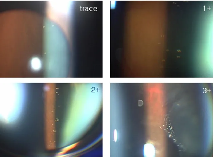 Figure 1. The grading scales according to the number of the clear oil-drop residue. Trace, below 3; 1+, more than 4, less than 10; 2+, more than 11 but less than 20; 3+, more than 21 in 1×3 mm slit beam.