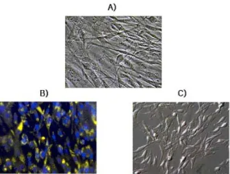 Figure 2. Adipose stem cells (ASCs) and endothelial progenitor cells (EPCs). (A) Light microscope image of  cultured ASCs; (B) Nile red O staining of ASCs(DAPI nuclear counter staining); (C) Phase contrast microscope image of cultured EPCs.