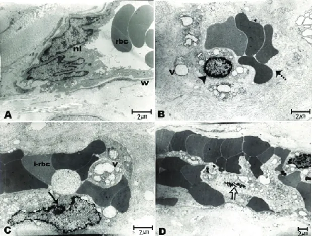 Figure 4. Electron microphotographs showing endothelial cellular changes in the new corneal vessels after PDT