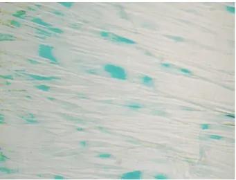 Figure 3. Photograph of SA-β-gal positive senescent  trabecular meshwork cells (blue color) after exposed to 0.05  mM of hydrogen peroxide