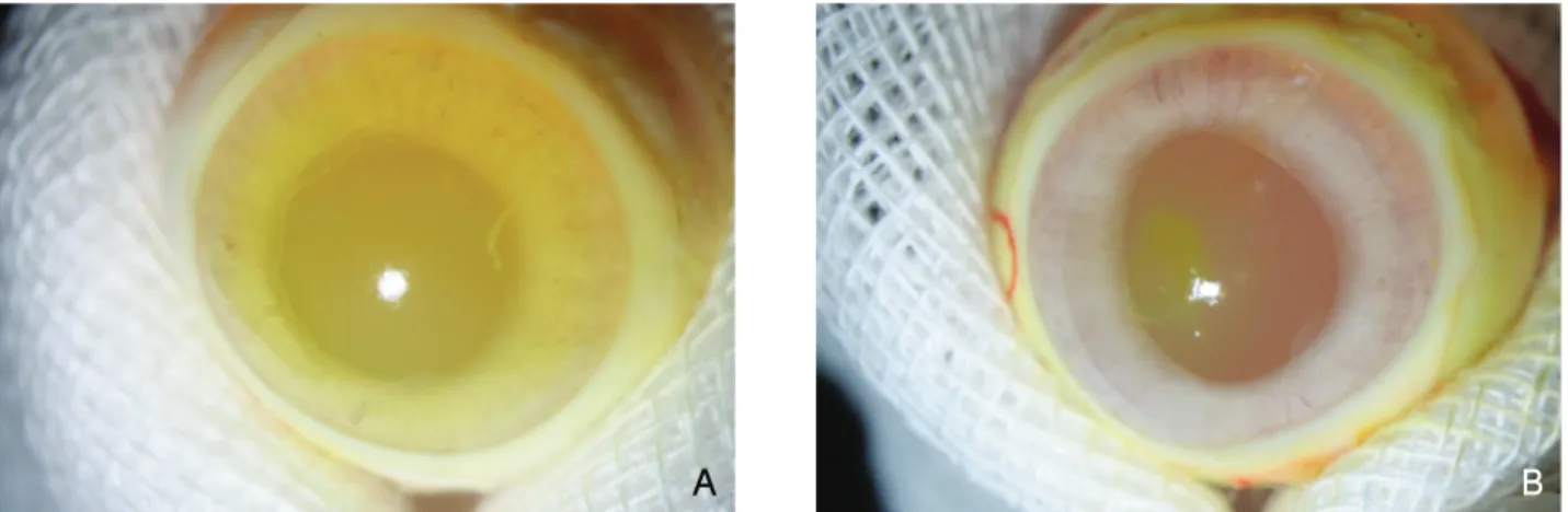 Figure 3. Scanning electron micrographs of the internal surface of a color contact lens (×100)