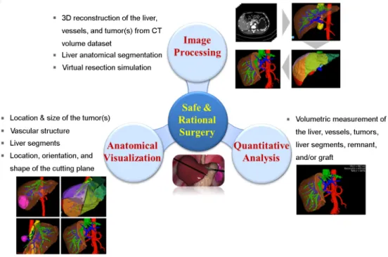 Figure 1. Information required for safe and rational liver surgery 