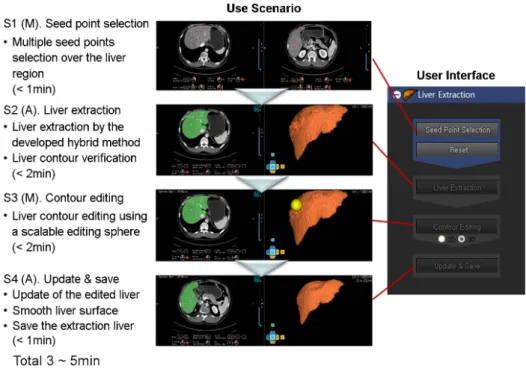 Figure 5. Use scenario and user interface of liver reconstruction module in Dr. Liver (A: automatic mode; M: manual mode) 