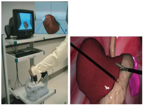 Figure 1과  같이  가상의  수술환경을  화면으로 보면서 동 기화된  수술  장비를  조작하여  가상의  환자를  치료하는  방식