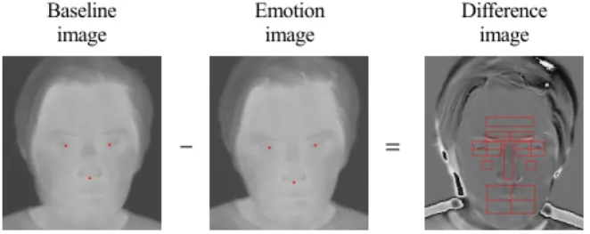 Figure 1. Thermal image and facial feature areas 