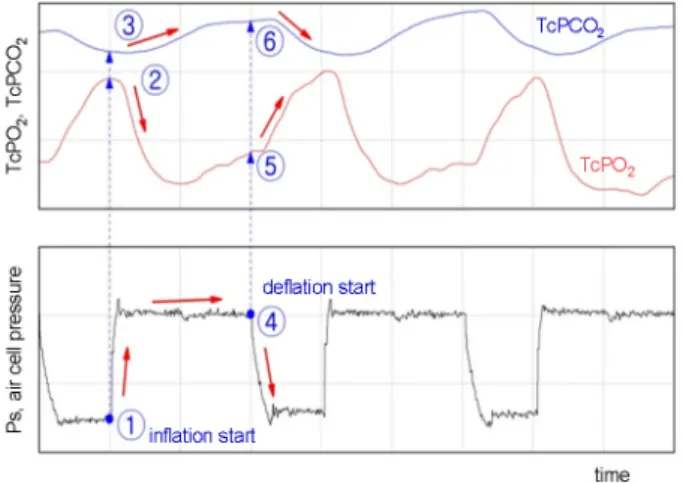 그림 6. 공기-셀에 작용하는 교대부양 부하압력(Ps)의  주기적 변화가 TcPO 2 , TcPCO 2  반응에 미치는 영향 