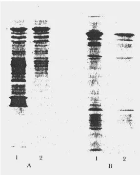 그림 12-17. Isoelectric focusig에 의하여 분리된 두 단백질 혼합물 (1 과 2) (A) 일반적 실험체계; (B) 고해상력 실험체계 12-4
