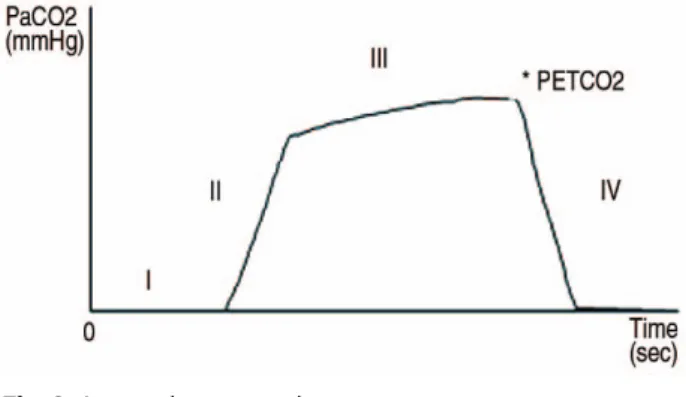 Fig. 2. A normal capnography