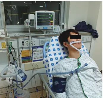 Fig. 1. Oxygen therapy via high flow nasal canula device.
