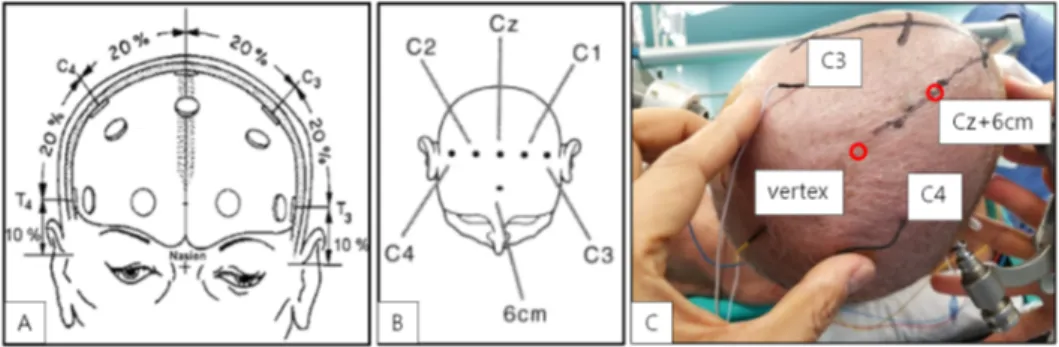 Figure  1.  The  current  headset  design  implements  the  10-20  system  the  internationally  recognized  method  for  placing electrodes on the human scalp  in  the  context  of  EEG.