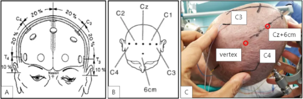 Figure  1.  The  current  headset  design  implements  the  10-20  system  the  internationally  recognized  method  for  placing electrodes on the human scalp  in  the  context  of  EEG.