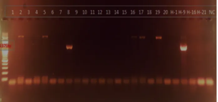 Figure  3.  Multiplex  PCR  assay  identifies  SCC mec   types  and  sub- sub-types  simultaneously  detects  the  methicillin  resistance  (SCC  mec subtypes).
