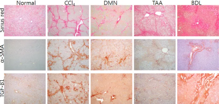 FIG. 2 . Histopathological changes and morphometric quantitiative analysis results of liver sections stained with  sirius red and  immunostained with α-SMA and TGF-β1