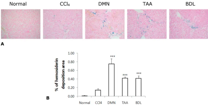 Fig. 3 . Iron deposition and morphometric quantitiative analysis results of liver sections stained with prussian blue in rats induced  by CCl 4 , DMN, TAA and BDL (×200)