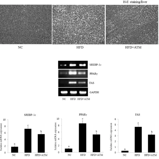 Fig. 4. Effect of ATM on hepatic  mRNA expresssion of lipogenesis-  related genes in high fat diet-fed  rats