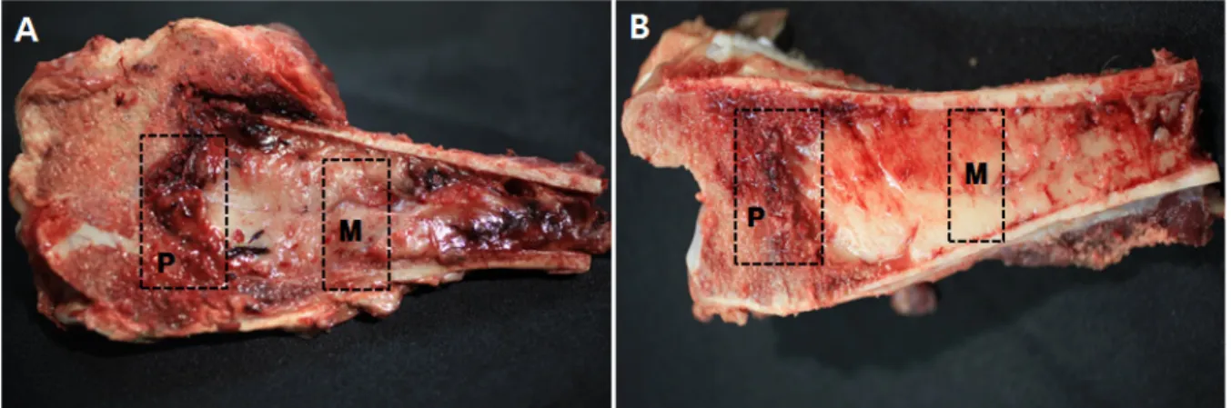 Fig. 1. Gross findings in proximal and distal tibia. In proximal (A) and distal (B) tibia, the physis showed irregular thickening of cartilage and  hemorrhage