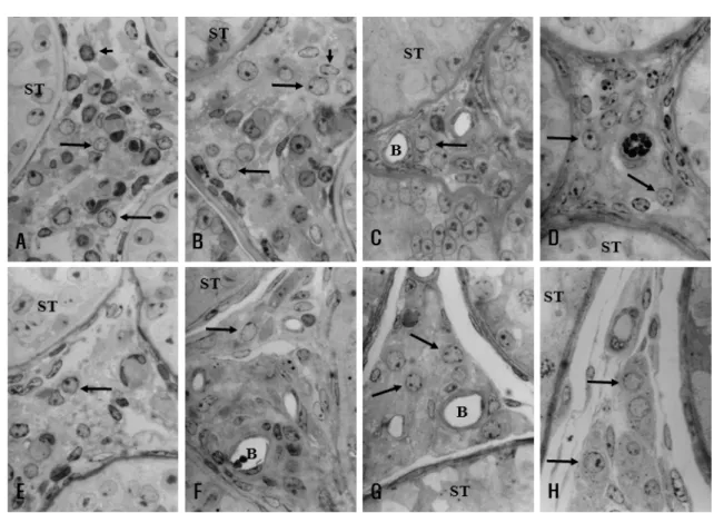 Fig. 1. Representative light micrographs showing testis of Korean native cattle at postnatal ages 14 (A), 17 (B), 20 (C), 25 (D), 30 (E), 35 (F), 40  (G), and 104 (H) weeks