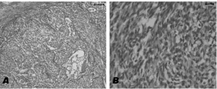 Fig. 2. Histopathological findings of the mammary mass. The dominant component of the tumor was the bundles of spindle-shaped cells