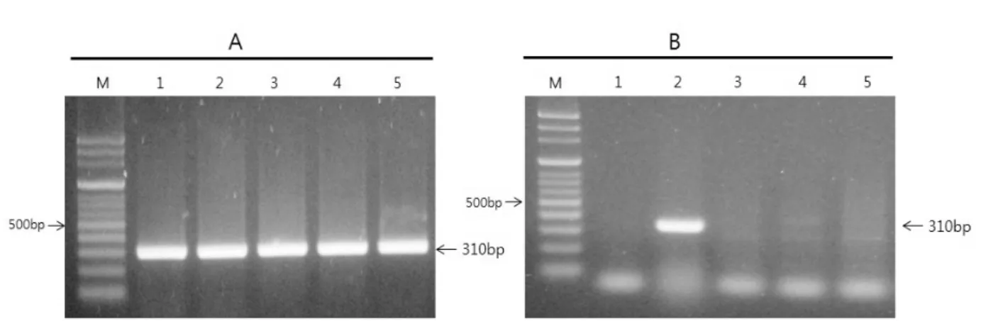 Fig. 3. Allignment of nucleotide sequence of the amplified partial large T antigen gene of avian polyomavirus (APV) in this case and seven  strains of APV reported by Katoh et al