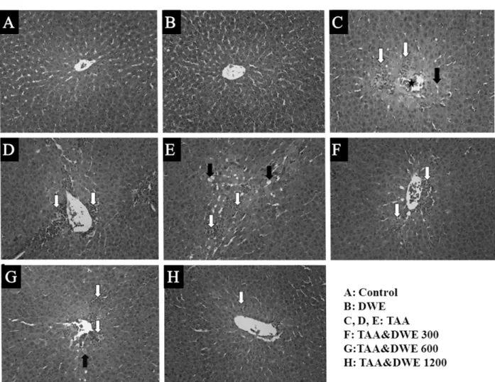 Fig. 4. Liver sections of treated with TAA and/or DWE. Livers from control and DWE groups (A, B) showing normal appearance