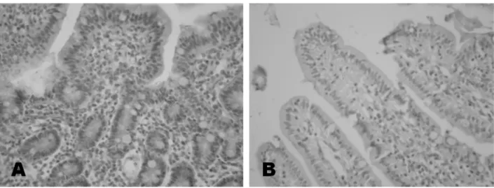 Fig. 2. Histopathological findings of small intestine. H&amp;E stain, ×100, (A) Group II: pathogenic E