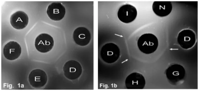 Fig. 1. Agar gel immunodiffusion test demonstrating the presence  of IBDV in bursal samples of affected chickens