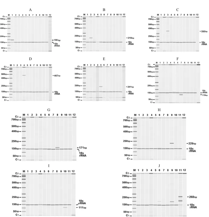 Fig. 2. Multicapillary electrophoresis size determination panel of singleplex PCR amplification products obtained using (A) cattle-, (B) sheep-, (C)  goat-, (D) horse-, (E) dog-, (F) pig-, (G) chicken-, (H) duck-, (I) goose-, (J) turkey-specific primers