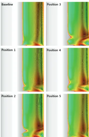 Fig.  9  Negative  sign  shear  stress  contour  on  1st  tube  surface  ( ,  Re  =  10000).