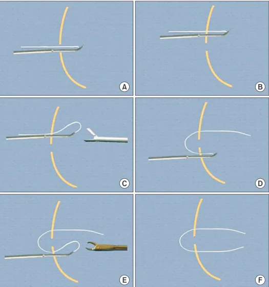 Fig. 1. Schematic drawings showing the 