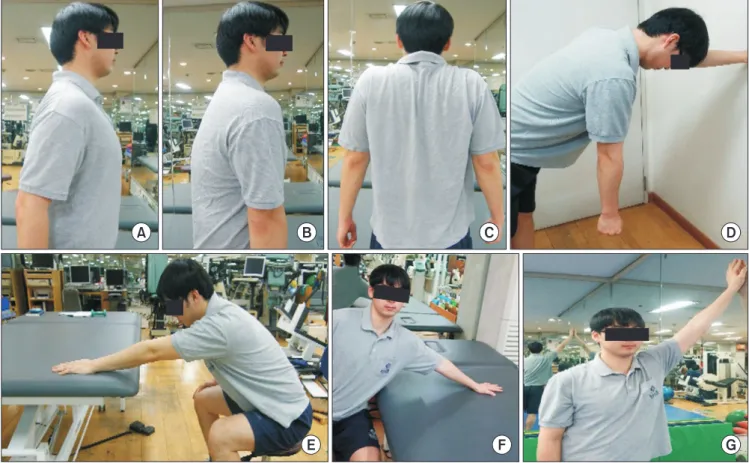Fig. 1. Scapular mobilization exercise (A–C) and pendulum exercise (D) were conducted to improve the movement of the scapula before the range of motion exer- exer-cise