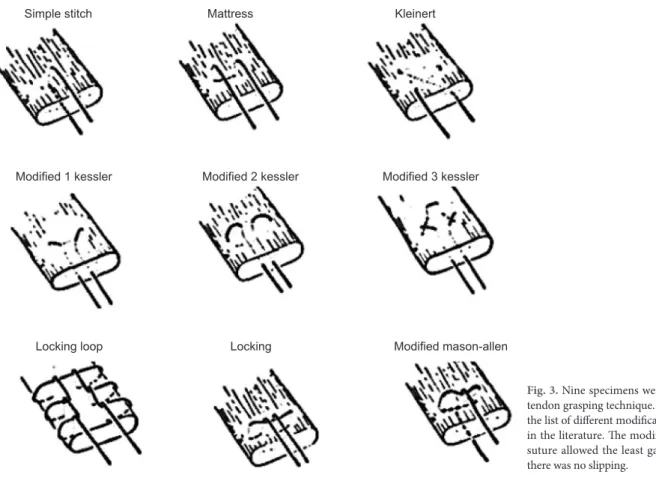 Fig. 3. Nine specimens were tested for each  tendon grasping technique. Th  is fi gure shows  the list of diff erent modifi cation of single row  in the literature
