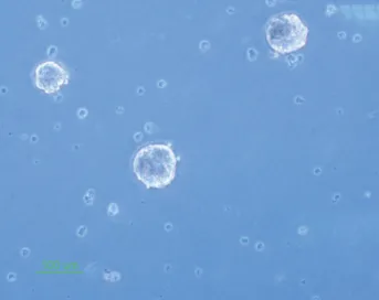 Fig. 3. Neural stem cell differentiation to three neural lineages (×10). 