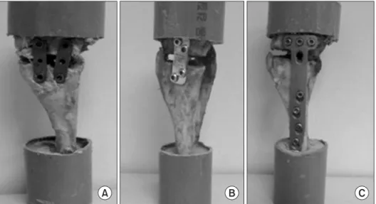Fig. 2. Testing arrangement with axial loading of opening wedge high  tibial osteotomy using mechanical testing system (Instron).