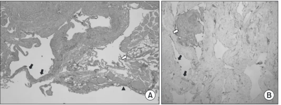 Fig. 5. Postoperative radiograph at 2 years after operation shows no abnormal  findings.