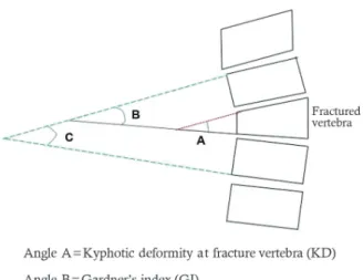 Fig. 1. Diagram showing calculations of various kyphotic deformities.