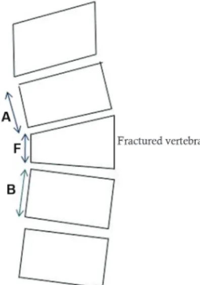 Table 1 shows various radiological parameters of the  spine. The average preoperative SI of 22.75±8.29°  im-proved to 12.39±6.68° postoperatively