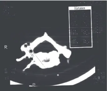 Fig. 4. Computed tomography measurement of linear parameters.