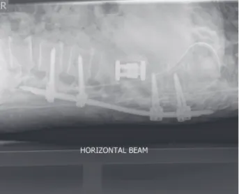 Fig. 2. A lateral radiograph of the same patient as in Fig. 1.