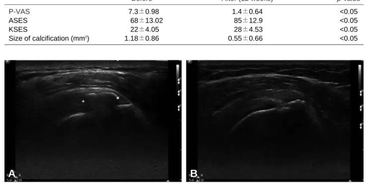Table 2. Clinical and sonographic results before and after treatment