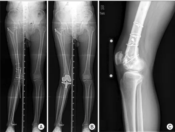 Fig. 5. Radiographic images of case No. 9: 