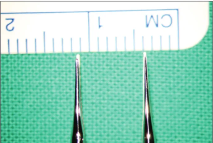 Fig. 3. (A) The application of super- super-microsurgery (perforator to perforator  anastomosis) on the lower extremity  is  shown
