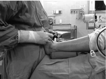 Figure 2. Arthroscopic exam. From lateral gutter to anterior, central and medial gutter of ankle.